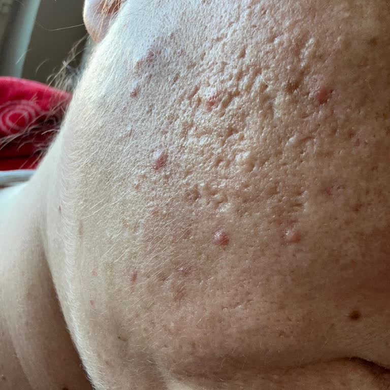 Estee Lauder Seti Cilt Sorunları Yarattı