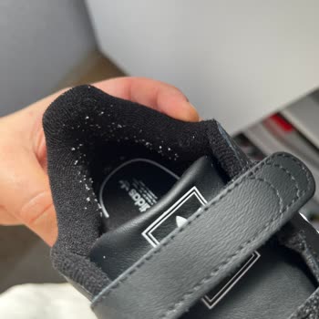 Aldığım Çocuk Ayakkabısı İki Haftada Tüylendi