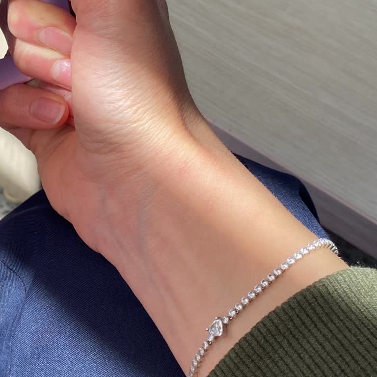 Pandora Bilekliğimde Taş Düşmesi Ve Kararma Sorunu