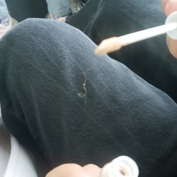 Kapatıcıdan Çıkan Plastik Şaşkınlığı