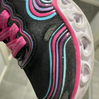 Skechers Ayakkabıda Kalite Sorunu