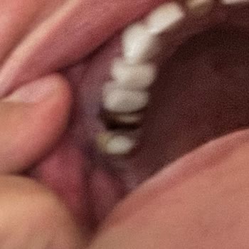 Diş Tedavisi Kabusu: Clinic Ego'nun Yetersiz Hizmetleri