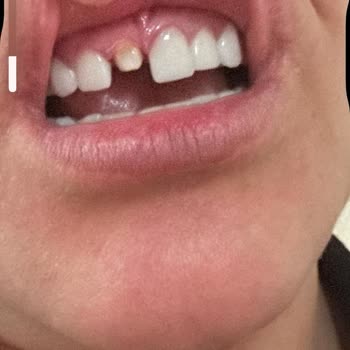 Diş Tedavisi Kabusu: Clinic Ego'nun Yetersiz Hizmetleri