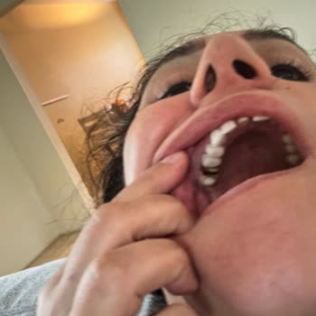 Diş Tedavisi Kabusu: Clinic Ego'nun Yetersiz Hizmetleri