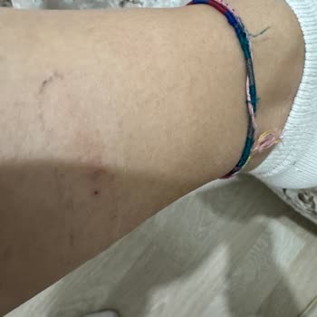 FLO Ayakkabı Yanlış Ürün Hatası Ve Müşteri Mağduriyeti