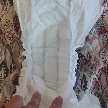 Sleepy Bebek Bezlerinde Sızdırma Ve Yara Sorunu