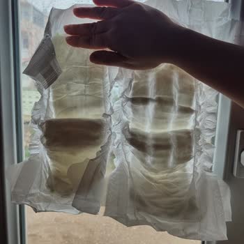 Sleepy Bebek Bezlerinde Sızdırma Ve Yara Sorunu