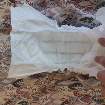 Sleepy Bebek Bezlerinde Sızdırma Ve Yara Sorunu