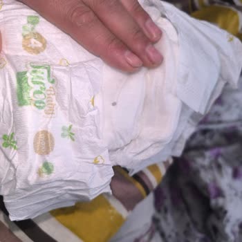 Kalite Kontrol Eksikliği: Bebek Bezi Sorunu