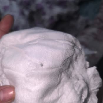 Kalite Kontrol Eksikliği: Bebek Bezi Sorunu