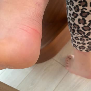 Intersport Ayakkabı Sorunları ve Mağduriyet