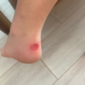 Intersport Ayakkabı Sorunları ve Mağduriyet