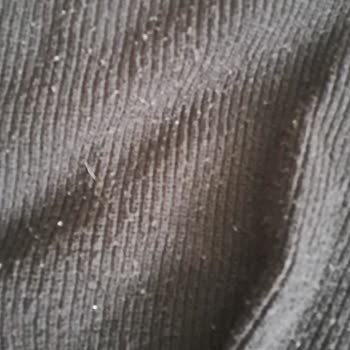 Kazak Tüylenmesi Ve Hatalı Kullanım İddiası