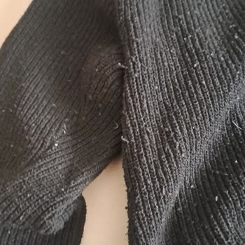 Kazak Tüylenmesi Ve Hatalı Kullanım İddiası