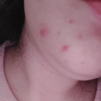 Benefit Mask from Sephora Caused Irritation and Strong Perfume Smell