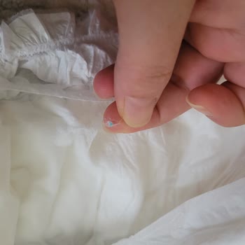 Hijyenik Olmayan Sleepy Bezde Sert Madde Şoku
