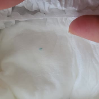 Hijyenik Olmayan Sleepy Bezde Sert Madde Şoku