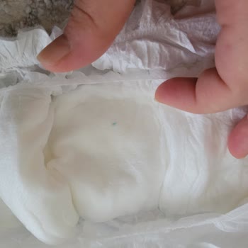 Hijyenik Olmayan Sleepy Bezde Sert Madde Şoku