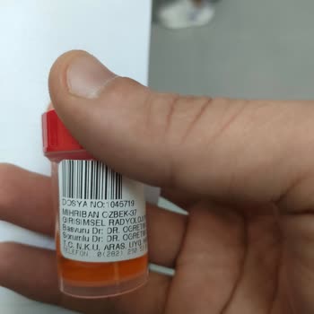 Biyopsi Sonuçları İçin Uzun Bekleyiş