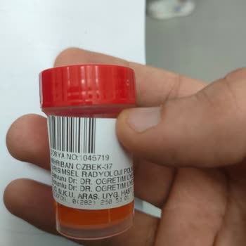 Biyopsi Sonuçları İçin Uzun Bekleyiş