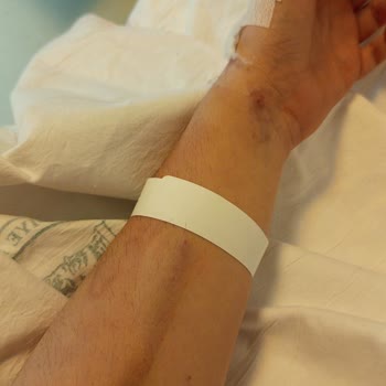 İstinye Devlet Hastanesi Damarlarımı Patlattılar!