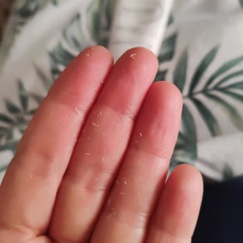 Bioderma Güneş Kremi Yüzümde Dökülüyor