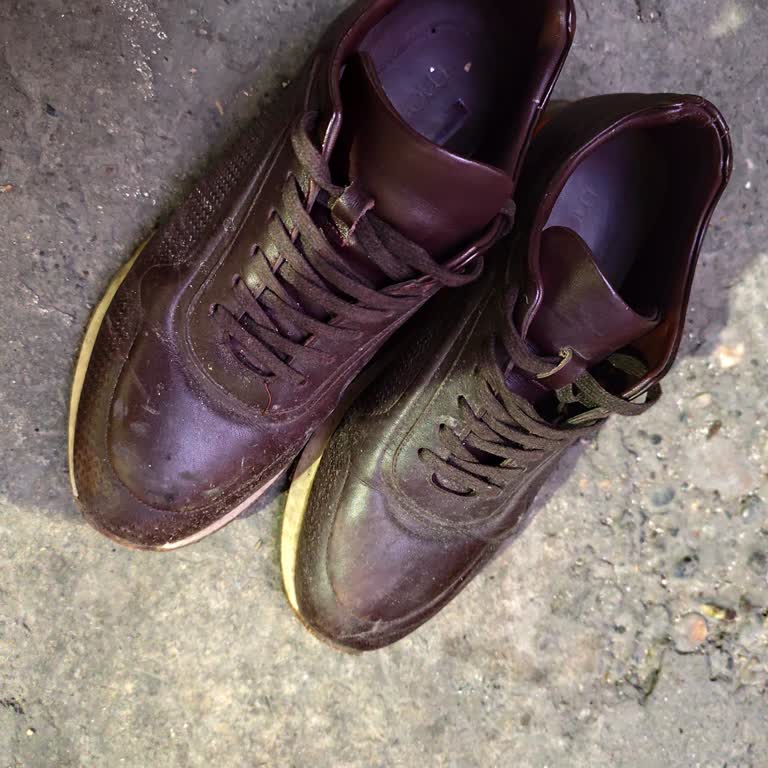 Ayakkabı Rahatsızlığına Çözüm Bulunamadı