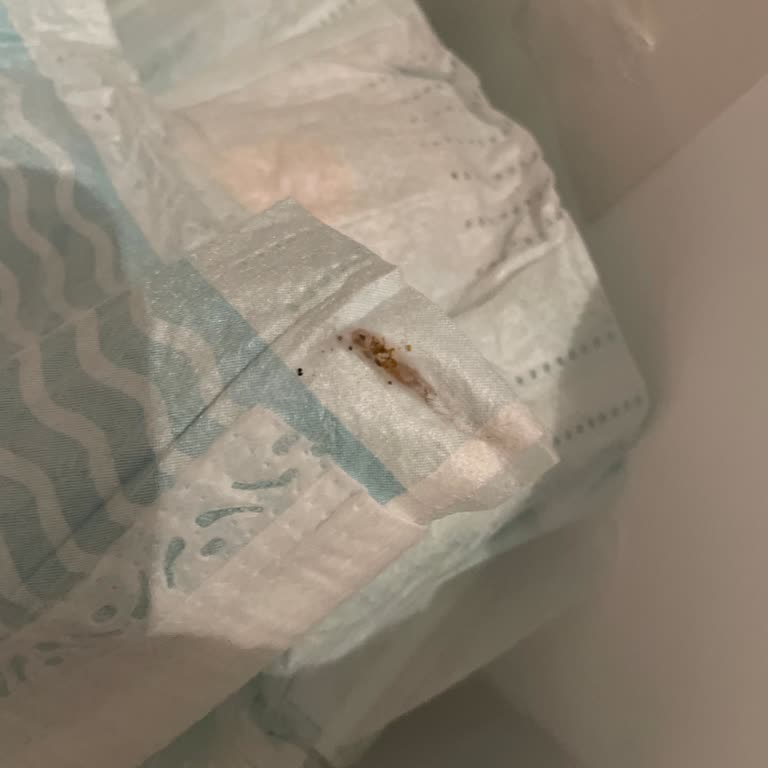 Prima Bebek Bezinde Kurtçuk Şoku: Sağlık Riski Ve Marka Güvenilirliği Sorgulanıyor