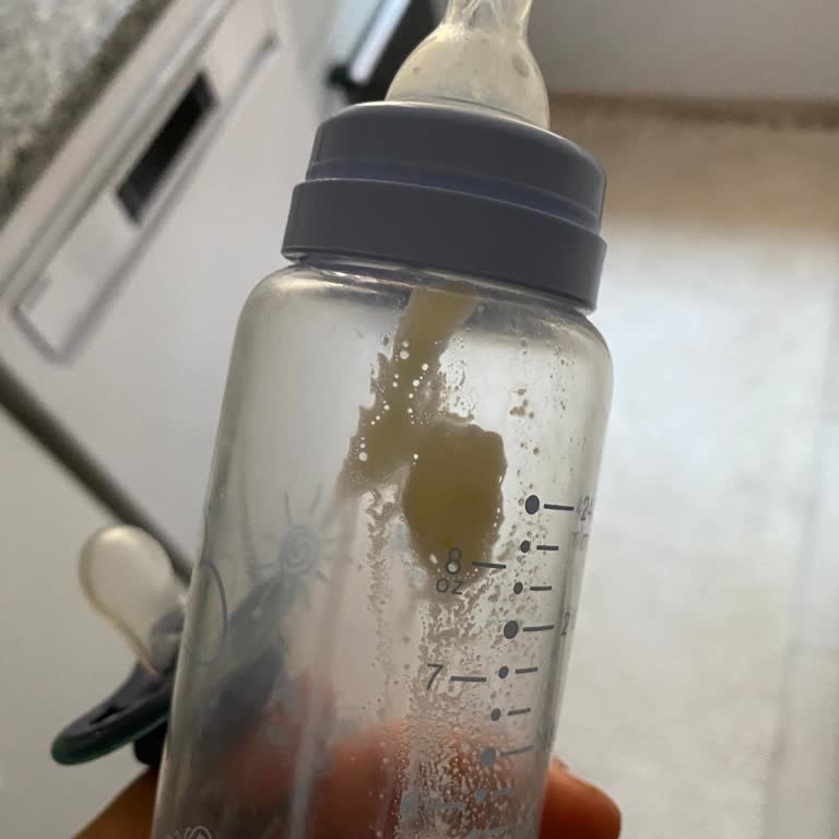 Sma Mama 2 Numara Çözünmeme Ve Gaz Problemi