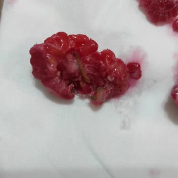 Harras Dondurulmuş Frambuazda Küf Ve Solucan Şoku