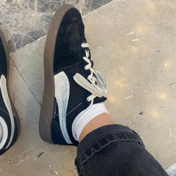 Zara Pantolon Boyası Sorunu Ve Yetersiz Müşteri Hizmeti