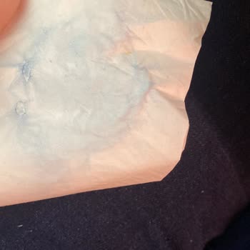 Zara Pantolon Boyası Sorunu Ve Yetersiz Müşteri Hizmeti