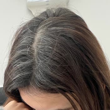 Biberiye Suyu Spreyi Beklentileri Karşılamadı