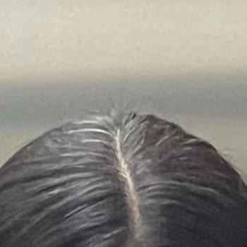 Biberiye Suyu Spreyi Beklentileri Karşılamadı