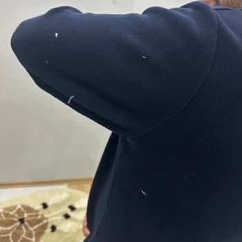 Kaz Tüyü Sorunu: Montumdan Memnun Değilim