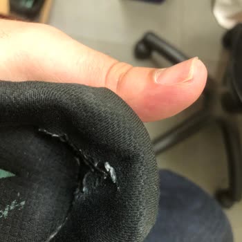 Skechers Ayakkabıda Erken Yıpranma Ve İlgisizlik