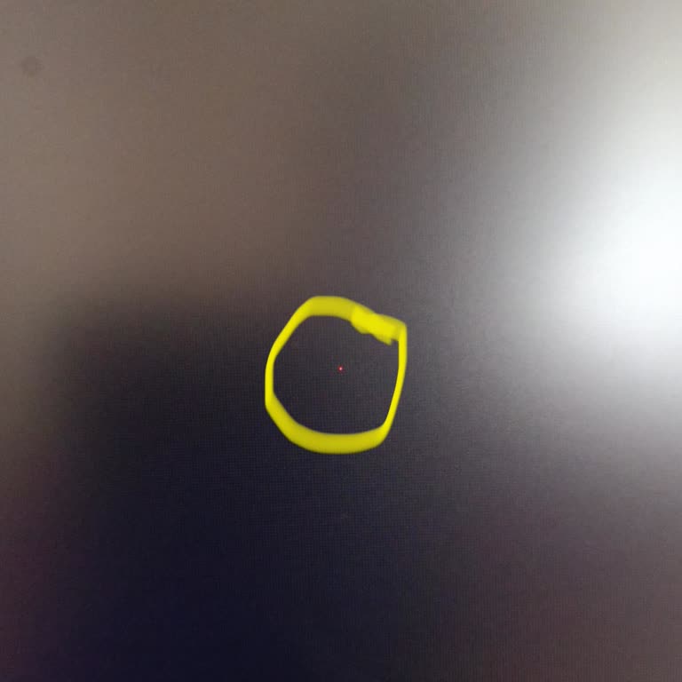 Ölü Piksel Sorunu Ve İade Sürecinde Yaşanan Zorluklar