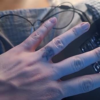 Dövme Silme Sonrası Kalıcı Hasar Şoku