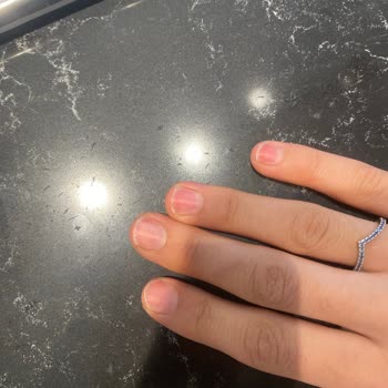 Protez Tırnak Çıkarma Kabusu: Kendi Tırnaklarım Zarar Gördü