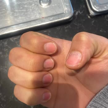 Protez Tırnak Çıkarma Kabusu: Kendi Tırnaklarım Zarar Gördü