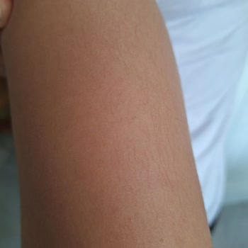 Meva Güzellik Merkezi Hizmet Kalitesinde Sorunlar Ve İletişim Eksiklikleri