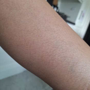 Meva Güzellik Merkezi Hizmet Kalitesinde Sorunlar Ve İletişim Eksiklikleri