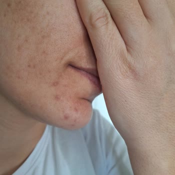 Meva Güzellik Merkezi Hizmet Kalitesinde Sorunlar Ve İletişim Eksiklikleri