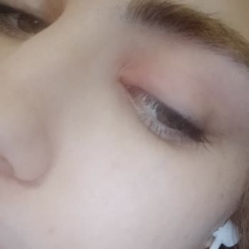 Göz Şişmesi Ve Yanma: Maskara Tehlikesi