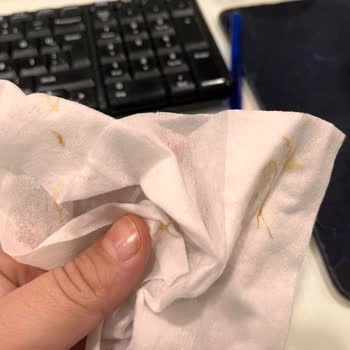 Sensodyne Sensitiv Weiß Zahncreme verursacht Hautablösungen im Mund