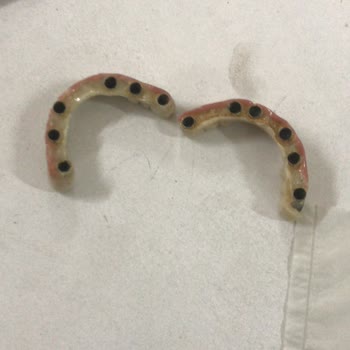 Via Dental Clinic Pişmanlıktır