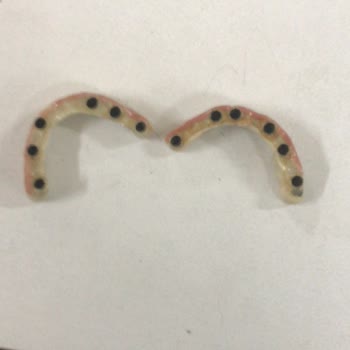 Via Dental Clinic Pişmanlıktır