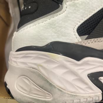 Boyalı Ayakkabı Ve Yırtık Çorap Sorunu