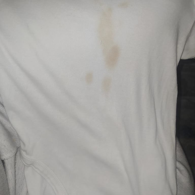 Arçelik Çamaşır Makinesi: Bitmeyen Sorunlar Ve Servis Çilesi