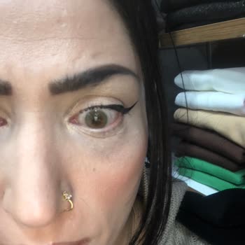 @fxeyesturkiye Hypnose Lenslerinde Kalite Sorunu Ve Kötü Müşteri Hizmeti